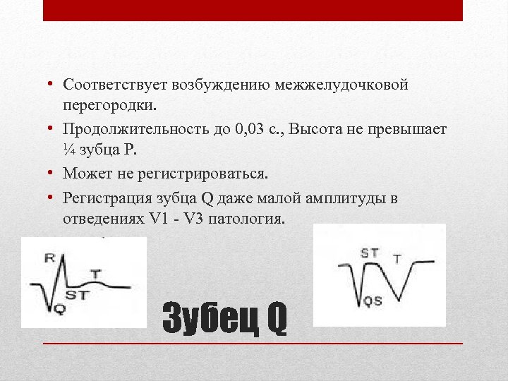  • Соответствует возбуждению межжелудочковой перегородки. • Продолжительность до 0, 03 с. , Высота
