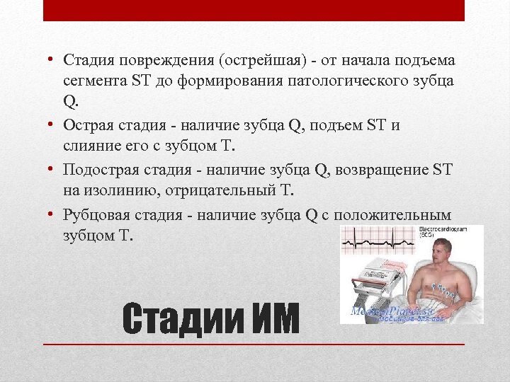  • Стадия повреждения (острейшая) - от начала подъема сегмента ST до формирования патологического
