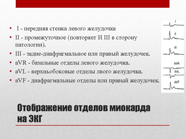  • І - передняя стенка левого желудочка • II - промежуточное (повторяет И