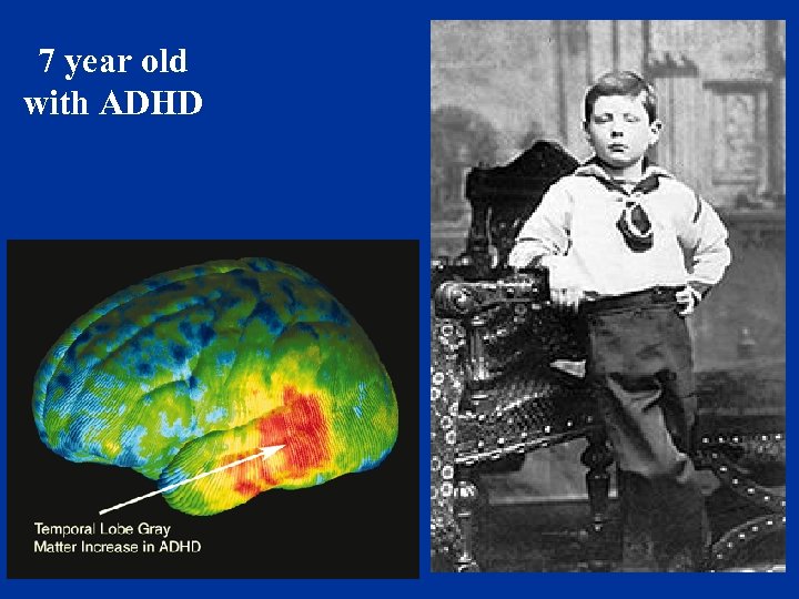 7 year old with ADHD 