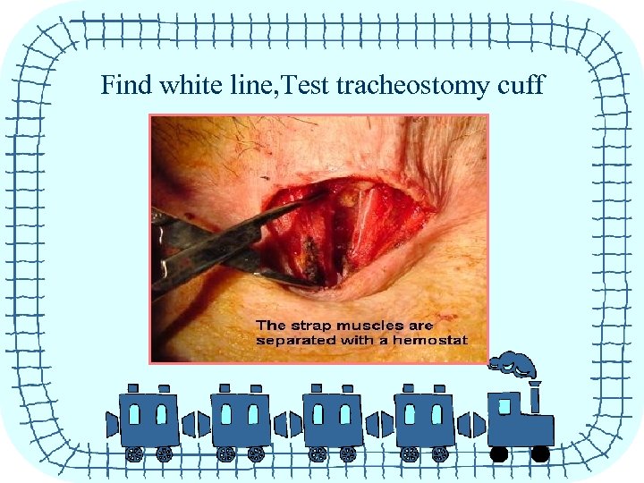 Find white line, Test tracheostomy cuff 