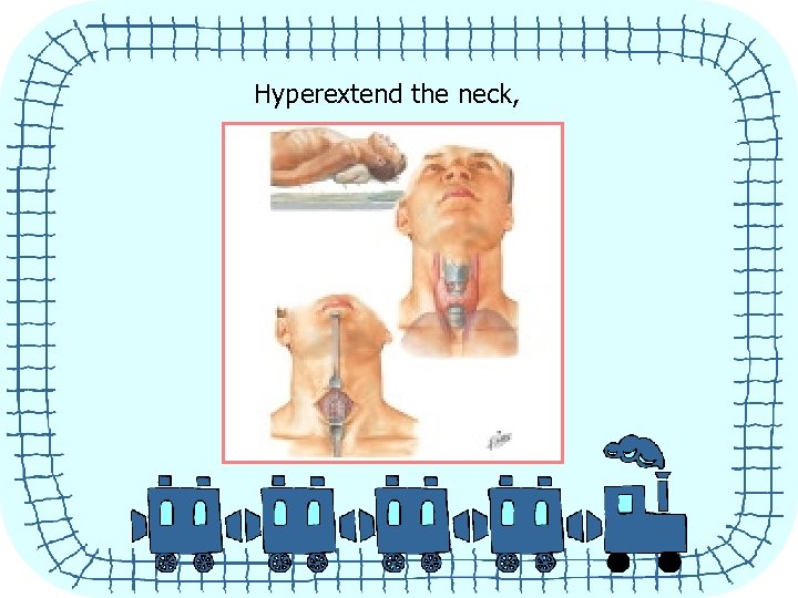 Hyperextend the neck, 