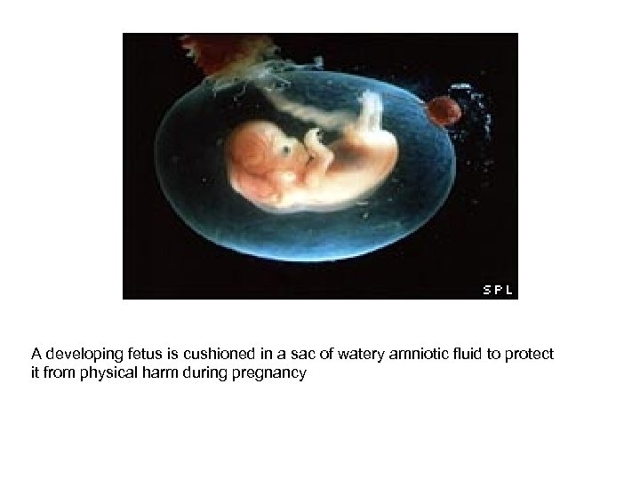 A developing fetus is cushioned in a sac of watery amniotic fluid to protect