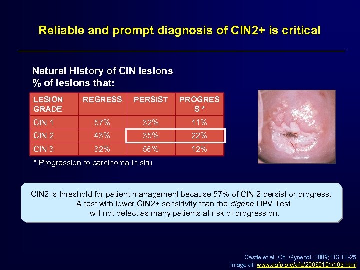 Reliable and prompt diagnosis of CIN 2+ is critical Natural History of CIN lesions