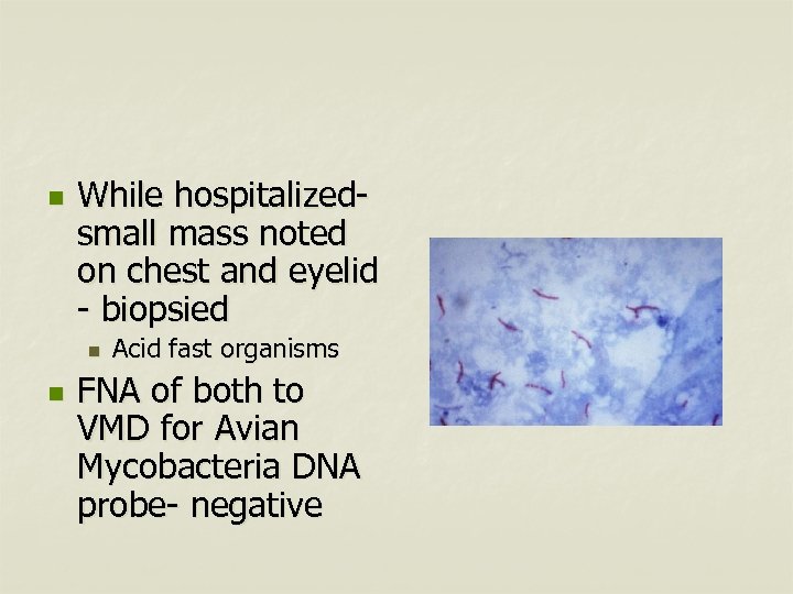 n While hospitalizedsmall mass noted on chest and eyelid - biopsied n n Acid