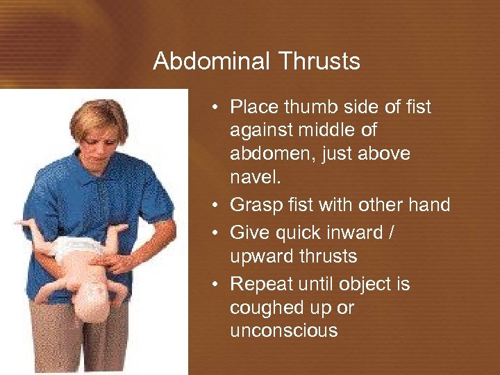 Abdominal Thrusts • Place thumb side of fist against middle of abdomen, just above