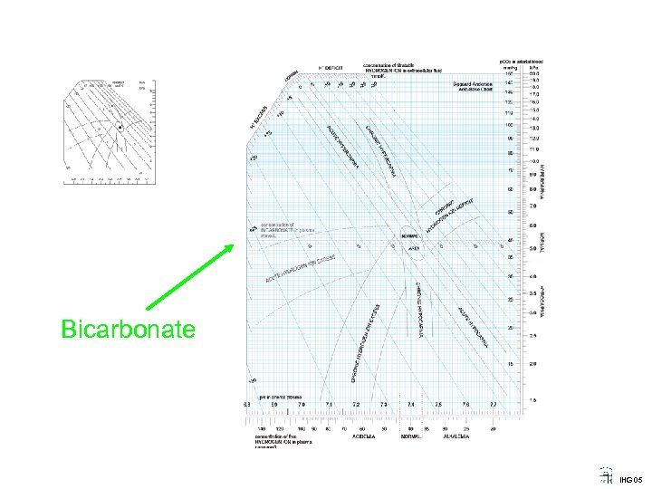 Bicarbonate IHG 05 