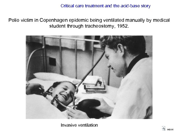 Critical care treatment and the acid-base story Polio victim in Copenhagen epidemic being ventilated