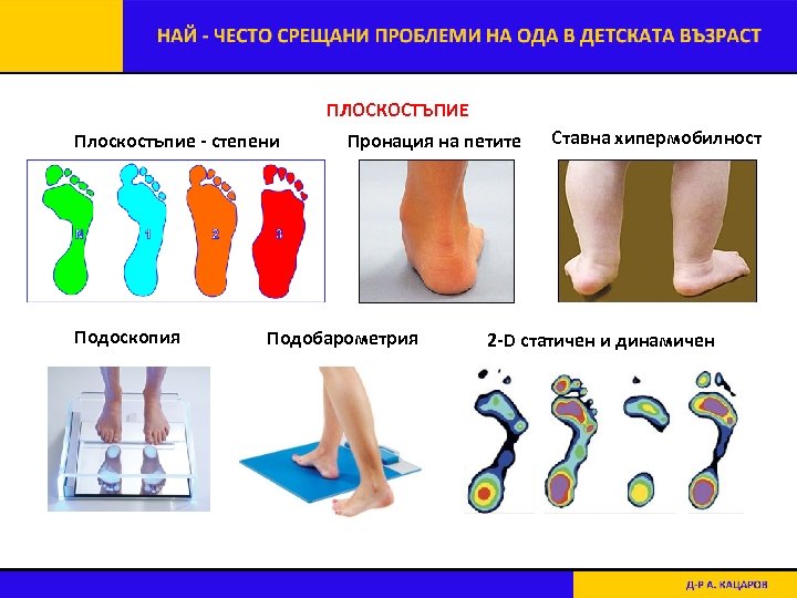 ПЛОСКОСТЪПИЕ Плоскостъпие - степени Подоскопия Пронация на петите Подобарометрия Ставна хипермобилност 2 -D статичен