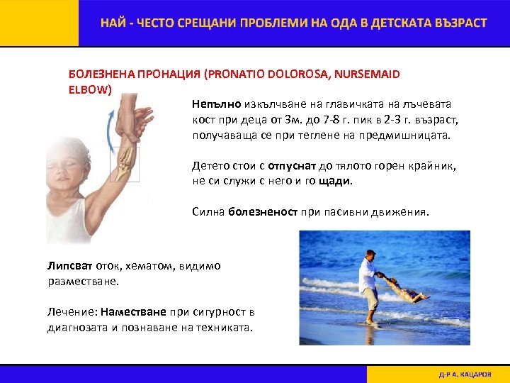 БОЛЕЗНЕНА ПРОНАЦИЯ (PRONATIO DOLOROSA, NURSEMAID ELBOW) Непълно изкълчване на главичката на лъчевата кост при