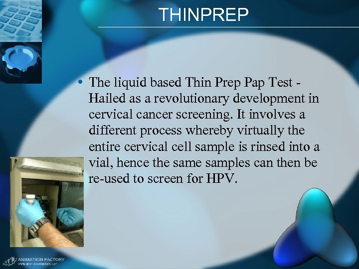 THINPREP • The liquid based Thin Prep Pap Test Hailed as a revolutionary development