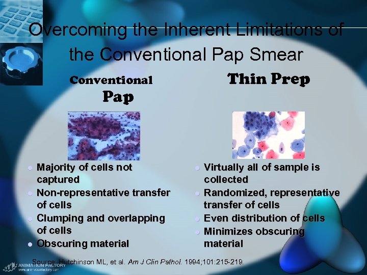 Overcoming the Inherent Limitations of the Conventional Pap Smear Conventional Thin Prep Pap l