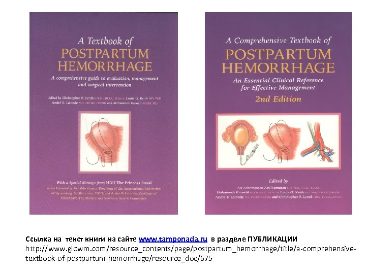 Ссылка на текст книги на сайте www. tamponada. ru в разделе ПУБЛИКАЦИИ http: //www.