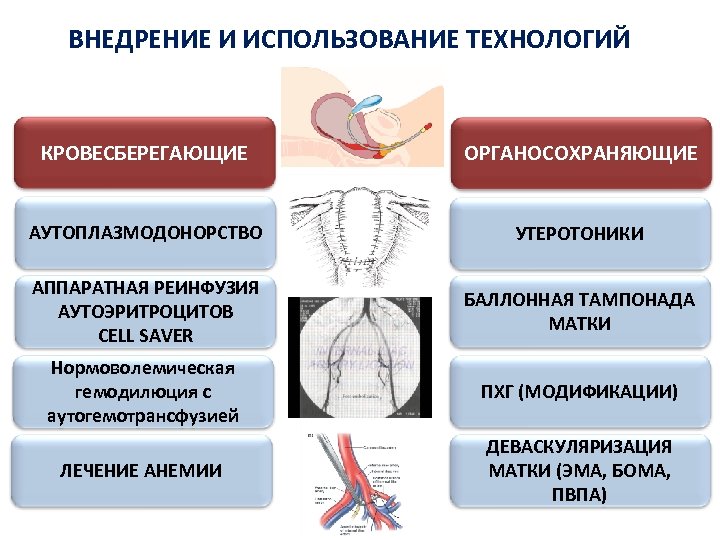 Баллонная тампонада матки презентация