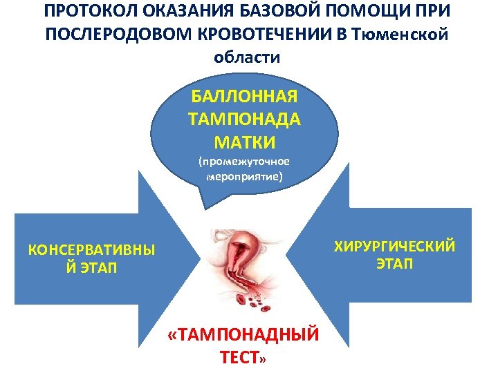 Баллонная тампонада матки презентация