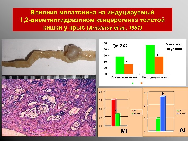 Влияние мелатонина на индуцируемый 1, 2 -диметилгидразином канцерогенез толстой кишки у крыс (Anisimov et