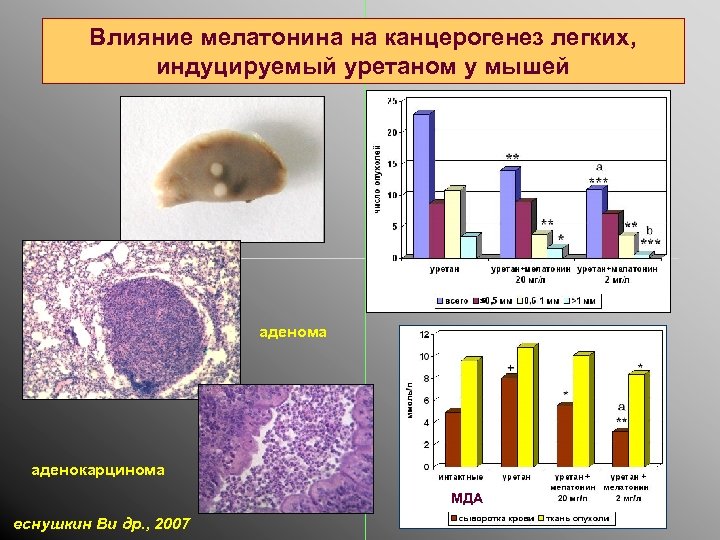 Влияние мелатонина на канцерогенез легких, индуцируемый уретаном у мышей аденома аденокарцинома МДА еснушкин Ви