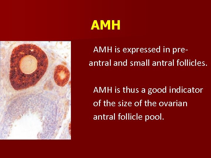 AMH is expressed in preantral and small antral follicles. AMH is thus a good