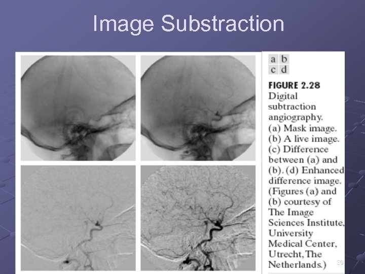 Image Substraction 30 