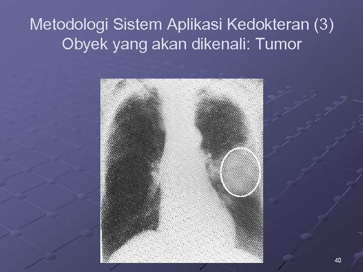 Metodologi Sistem Aplikasi Kedokteran (3) Obyek yang akan dikenali: Tumor 40 