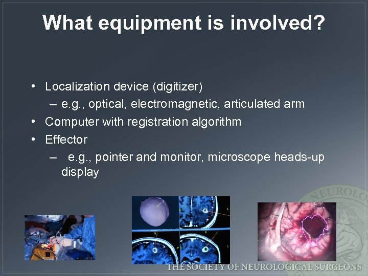 What equipment is involved? • Localization device (digitizer) – e. g. , optical, electromagnetic,