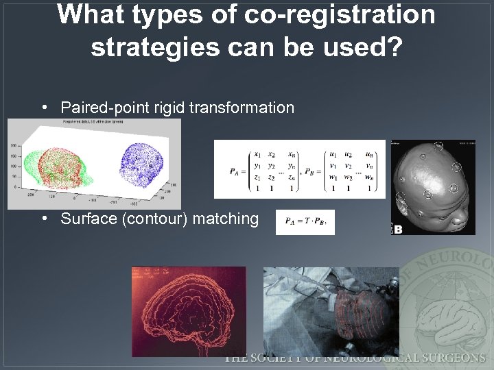 What types of co-registration strategies can be used? • Paired-point rigid transformation • Surface