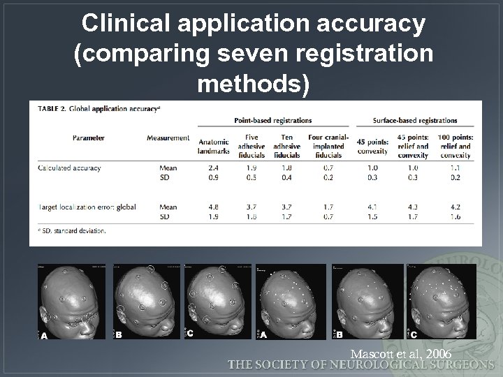 Clinical application accuracy (comparing seven registration methods) Mascott et al, 2006 