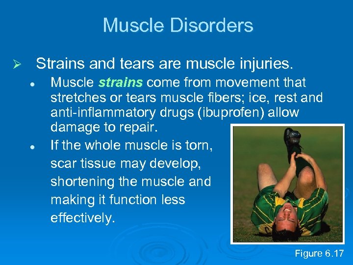 Muscle Disorders Strains and tears are muscle injuries. Ø l l Muscle strains come