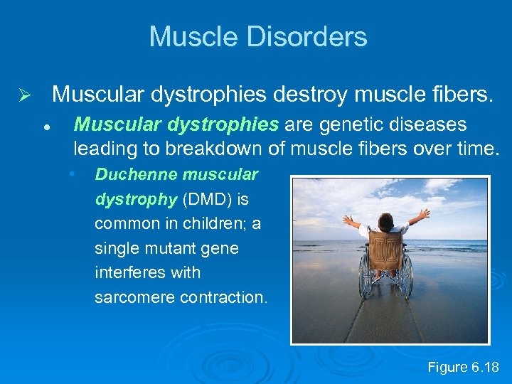 Muscle Disorders Muscular dystrophies destroy muscle fibers. Ø l Muscular dystrophies are genetic diseases