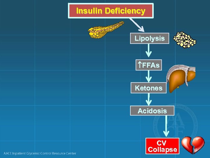 Insulin Deficiency Lipolysis FFAs Ketones Acidosis CV Collapse 15 