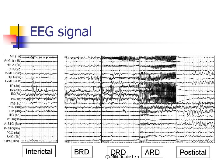 EEG signal © Miki Rubinstein 