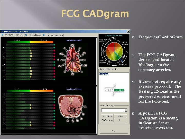  Frequency. CArdio. Gram The FCG CADgram detects and locates blockages in the coronary