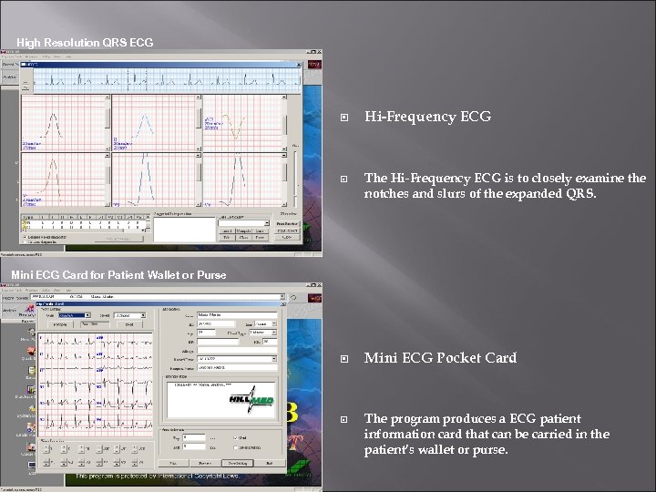 High Resolution QRS ECG Hi-Frequency ECG The Hi-Frequency ECG is to closely examine the