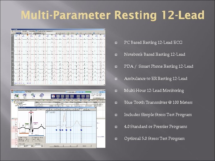  PC Based Resting 12 -Lead ECG Notebook Based Resting 12 -Lead PDA /