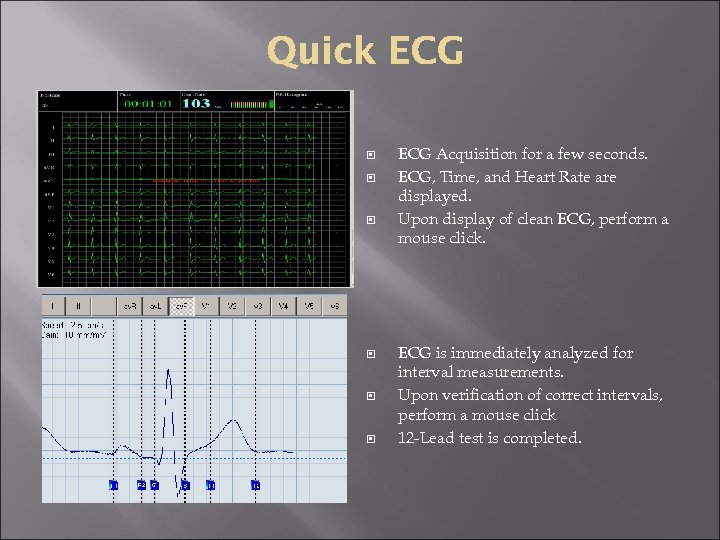  ECG Acquisition for a few seconds. ECG, Time, and Heart Rate are displayed.