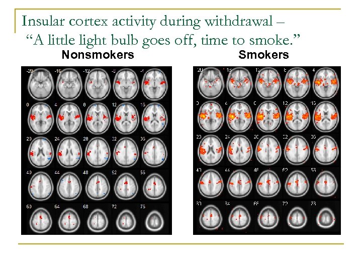 Insular cortex activity during withdrawal – “A little light bulb goes off, time to