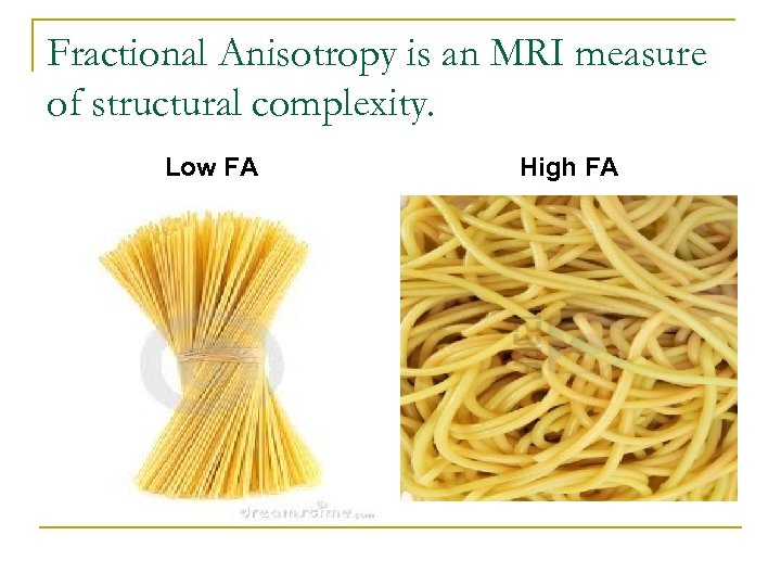 Fractional Anisotropy is an MRI measure of structural complexity. Low FA High FA 