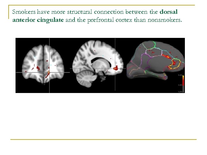 Smokers have more structural connection between the dorsal anterior cingulate and the prefrontal cortex