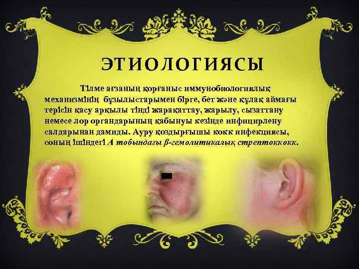 ЭТИОЛОГИЯСЫ Тілме ағзаның қорғаныс иммунобиологиялық механизмінің бұзылыстарымен бірге, бет және құлақ аймағы терісін қасу