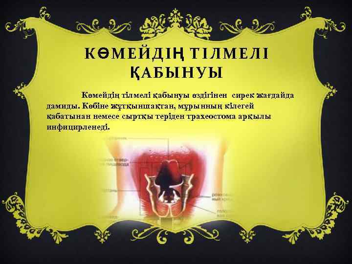 КӨМЕЙДІҢ ТІЛМЕЛІ ҚАБЫНУЫ Көмейдің тілмелі қабынуы өздігінен сирек жағдайда дамиды. Көбіне жұтқыншақтан, мұрынның кілегей