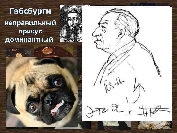 Габсбурги неправильный прикус доминантный 
