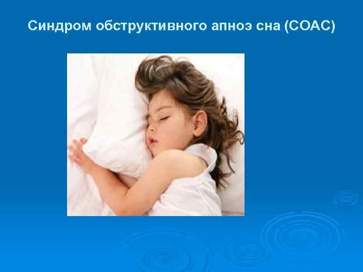Синдром обструктивного апноэ сна (СОАС) 