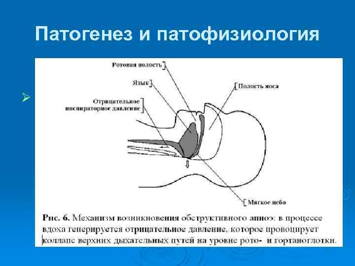Патогенез и патофизиология Ø 
