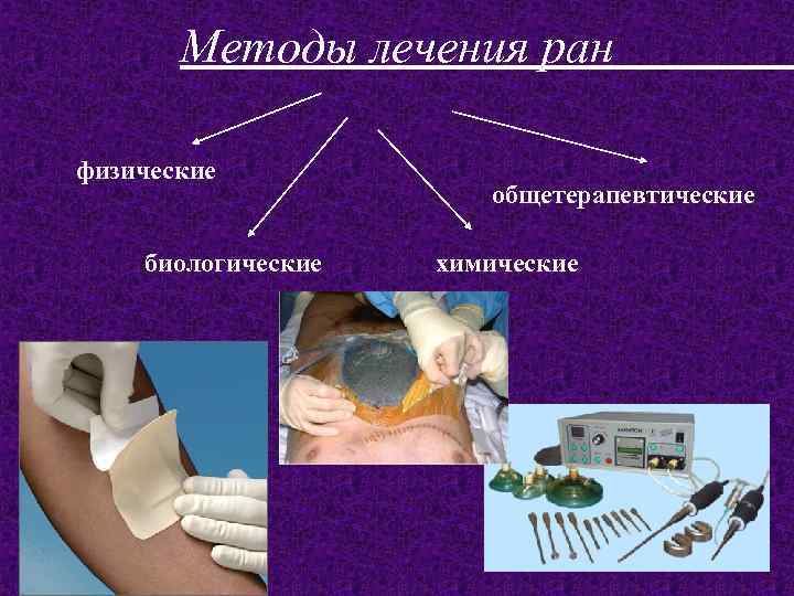 Методы лечения ран физические биологические общетерапевтические химические 