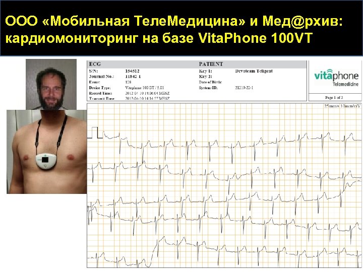 ООО «Мобильная Теле. Медицина» и Мед@рхив: кардиомониторинг на базе Vita. Phone 100 VT 