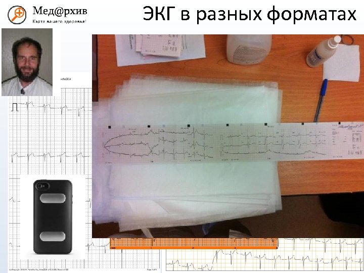 ЭКГ в разных форматах med@rhiv. ru www. medarhiv. ru 