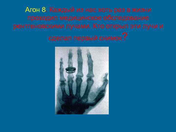 Агон 8. Каждый из нас хоть раз в жизни проходил медицинское обследование рентгеновскими лучами.