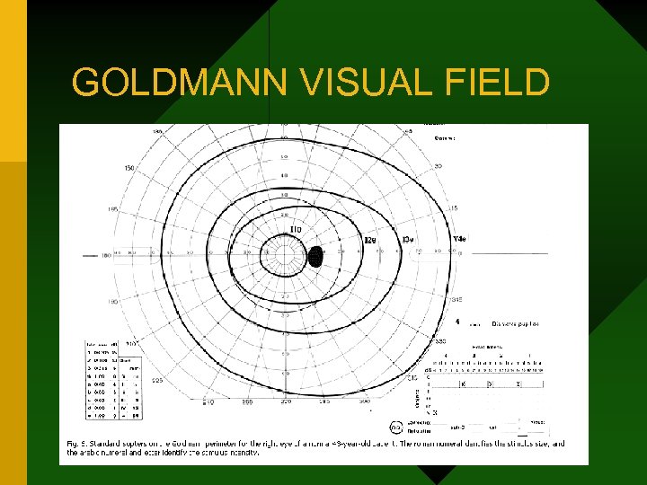 GOLDMANN VISUAL FIELD 