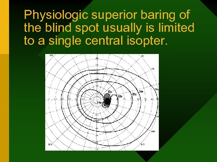 Physiologic superior baring of the blind spot usually is limited to a single central