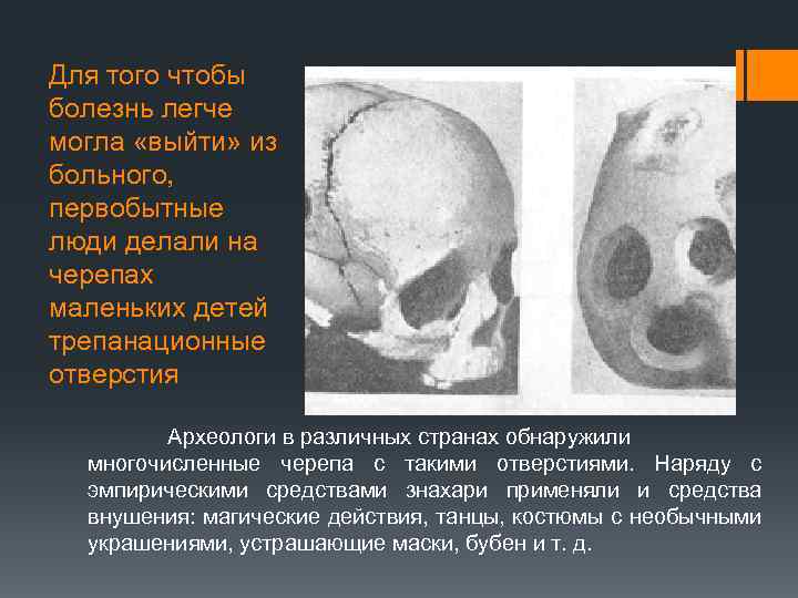 Для того чтобы болезнь легче могла «выйти» из больного, первобытные люди делали на черепах